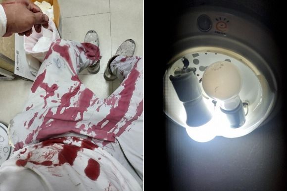 ìœ ë¦¬ë“± ë–¨ì–´ì ¸ í”¼ ì² ì² ì—˜ë² ê¸°ë‹¤ë¦¬ë‹¤ ‘ë‚ ë²¼ë ½’ ì•Šì•˜ë‚¼ 40ëŒ€ ê °€ìž¥ì ˜ í˜¸ì†Œ ì•Šì•˜ë‚¼ ì•Šì•˜ë‚¼ ì•Šì•˜ë‚¼ ì•Š