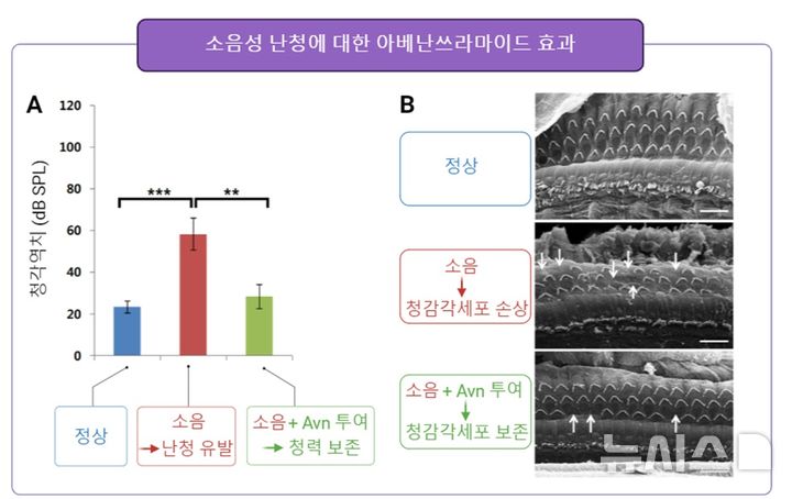 [세종=뉴시스]청성뇌간유발반응(ABR) 청력검사 결과. 소음에 의해 청력손실이 발생하는데 아베난쓰라마이드(Avn) 투여시 청력이 보존됨. B. 소음에 의한 청감각세포의 손상 및 Avn에 의한 보존 효과를 보여준다. 흰색 화살표는 손상된 세포의 모습.(사진=농진청 자료 캡쳐)