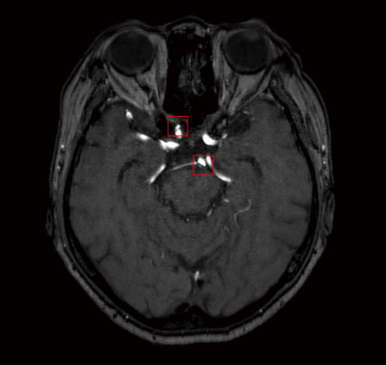 Unlock the Secrets of ‘Korean Wave’ with AI-Powered Insights: Unraveling the Mysteries of Hallyu