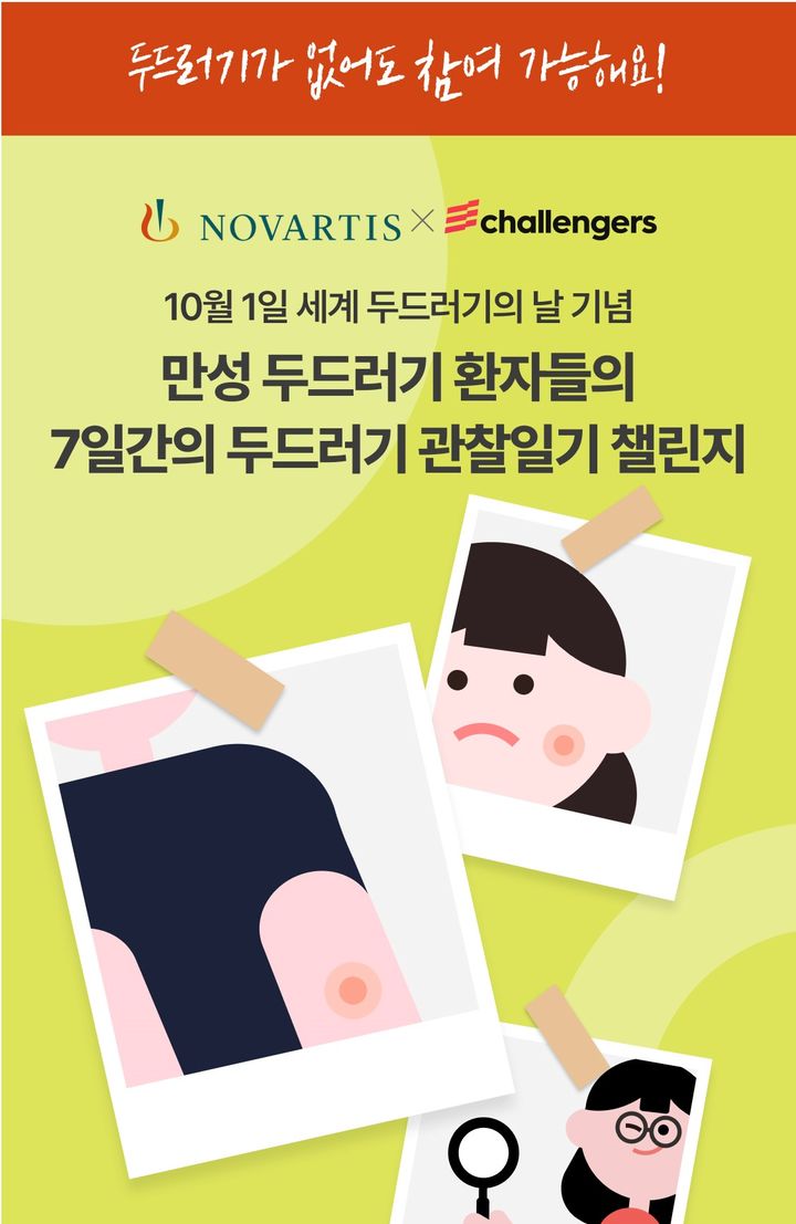 [서울=뉴시스] 한국노바티스는 10월1일 세계 두드러기의 날을 맞아 건강 습관 형성 플랫폼 ‘챌린저스’ 어플리케이션을 통해 만성 두드러기 환자들의 질환 관찰을 돕기 위한 ‘7일 간의 두드러기 관찰일기’ 캠페인을 진행한다. (사진=한국노바티스 제공) 2024.10.01. photo@newsis.com *재판매 및 DB 금지