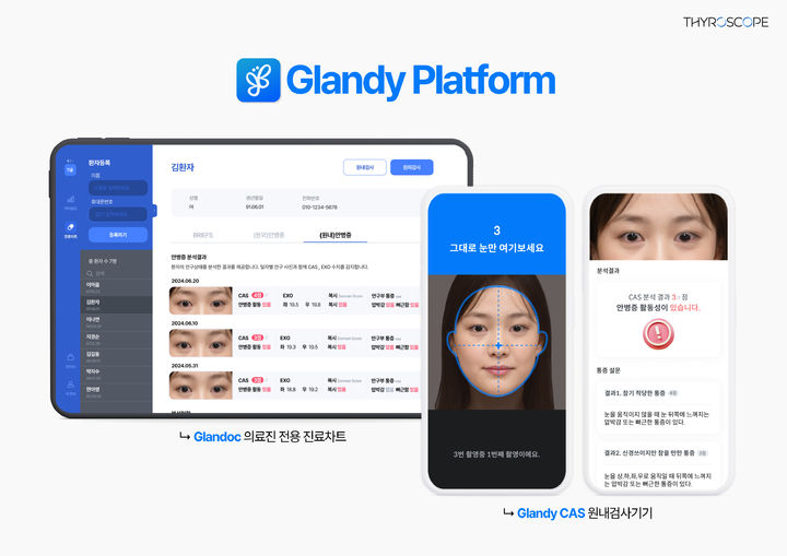 [서울=뉴시스] 타이로스코프가 개발한 글랜디 카스는 스마트폰으로 촬영한 안구부 이미지를 분석해 갑상선안병증의 활동성(CAS) 를 평가하는 AI 솔루션이다. (사진=타이로스코프 제공) 2024.10.11. photo@newsis.com *재판매 및 DB 금지