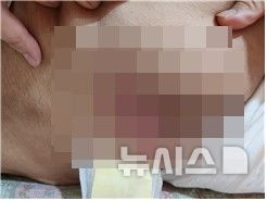 [포항=뉴시스] 안병철 기자 = 지난해 6월23일 오전4시40분께 경북 포항 한 요양병원에서 입원 환자가 욕창 등으로 사망했다.(사진=독자 제공) 2024.10.24. photo@newsis.com 