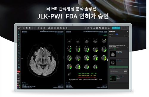 제이엘케이 뇌관류 MR 영상 분석 솔루션(JLK-PWI). (사진=제이엘케이 제공) *재판매 및 DB 금지