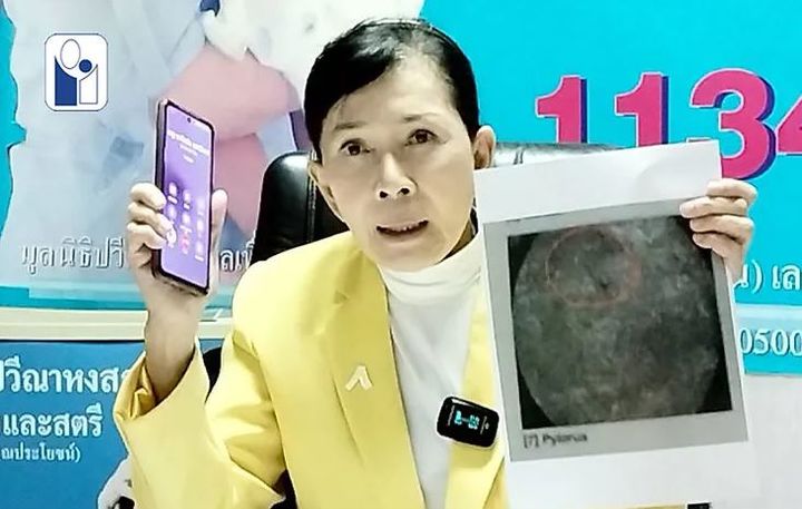 18ë…„ê°„ í•˜ë³µë¶€ í†µì¦ â€¦ì ˜ì‚¬ê°€ ë–¨ì–´ëœ¨ë¦° ‘ì£¼ì‚¿ë°”ëŠ˜’ ë•Œë¬¸ì ´ì—ˆë‹¤ :: ê³µê° ì–¸ë¡ ë‰´ì‹œìŠ¤ ::
