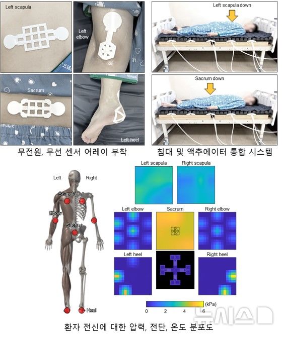 [창원=뉴시스]욕창 예방을 위해 환자에 적용한 센서 & 액추에이터 어레이 통합 시스템.(자료=국립창원대 제공) 2024.11.22.photo@newsis.com