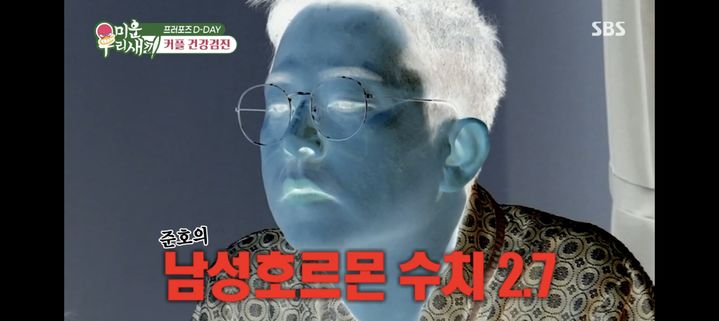 김준호, 남성 호르몬 '정상보다 낮은' 2점대 