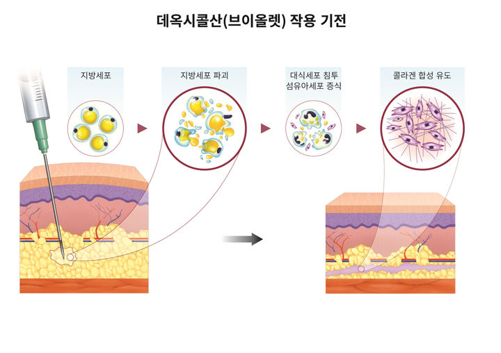 [서울=뉴시스] 데옥시콜산 작용기전 (사진=대웅제약 제공) 2025.05.19. photo@newsis.com *재판매 및 DB 금지