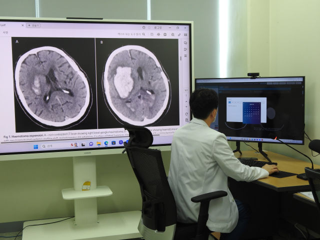 ​전문의 부족한 강원도…AI가 ‘뇌출혈 골든 타임’ 지킨다[빠정예진]  – 출장용접