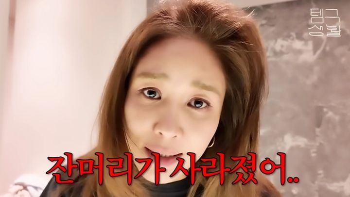 옥주현, 모발 이식 부작용 고백 