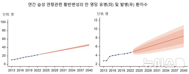 '실명 유발' 황반변성 유병률…2040년엔 현재의 2배로