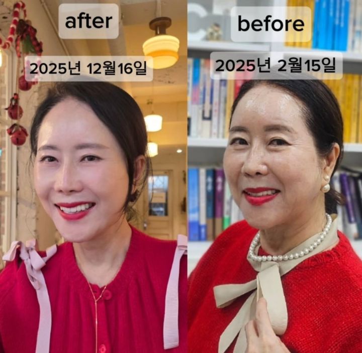 63세 윤영미, 확 달라진 얼굴…