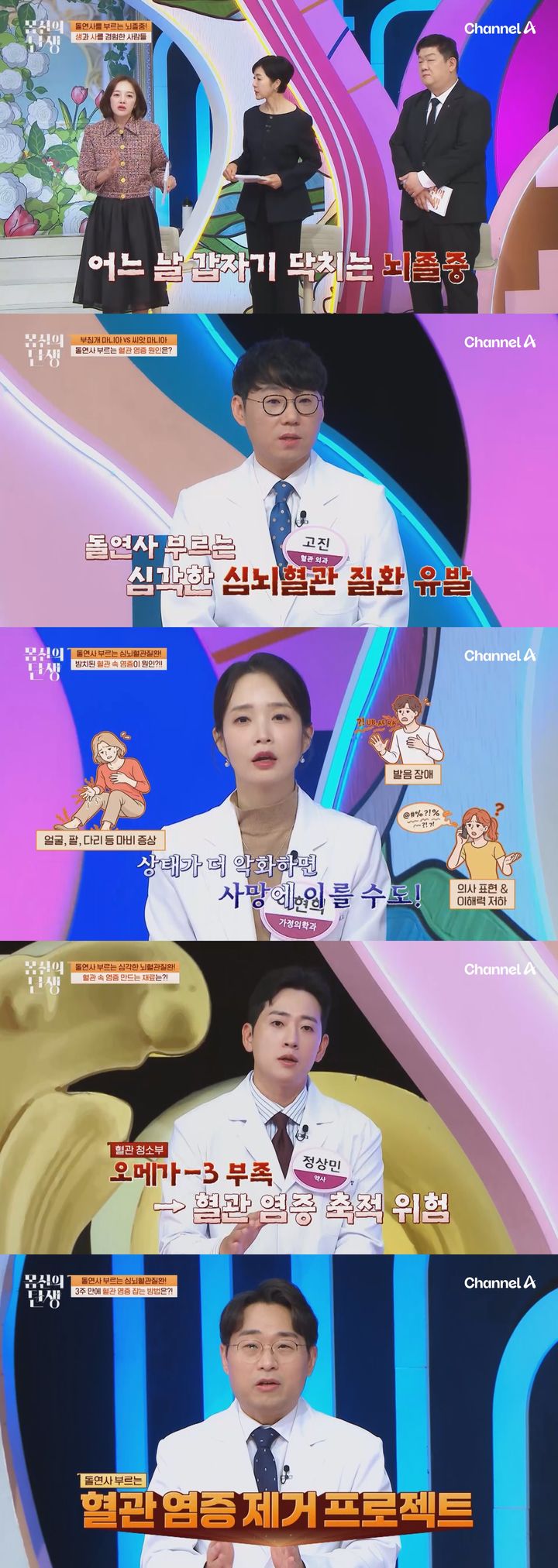 건강식이라 믿었는데…뇌졸중 부르는 식단?