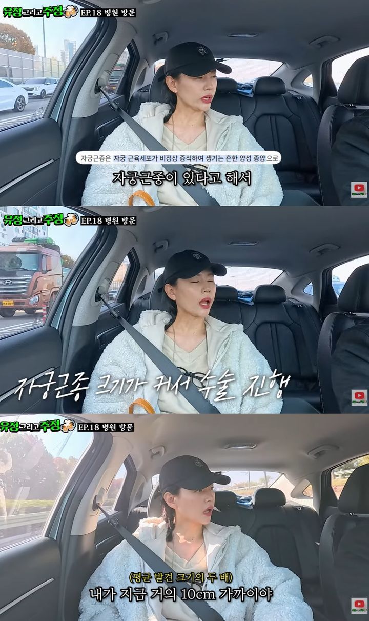 서유정, 자궁근종 10㎝ 발견…