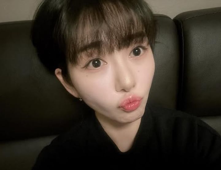 AOA 출신 권민아, 피부과 환불 갈등 왜? 대표 이미지