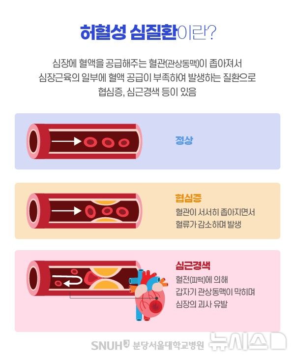 "발병시 26% 1년내 사망"…북극한파에 '이 질환' 초비상