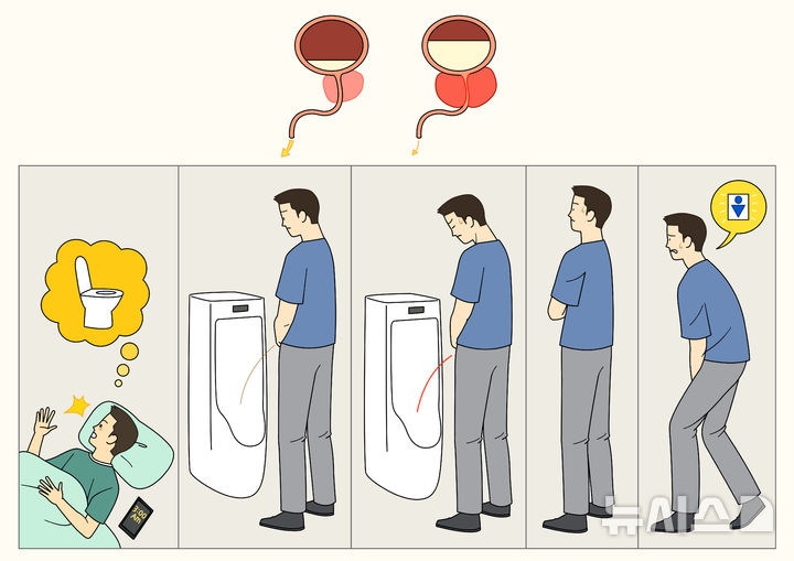 "소변줄기 약해졌어요"…'큰 일교차' 중년남성은 괴롭다