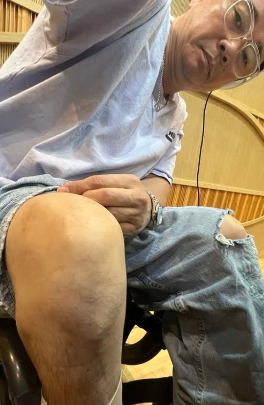 김송 "강원래 하반신 마비 25년…발톱 빠져도 통증 없어"