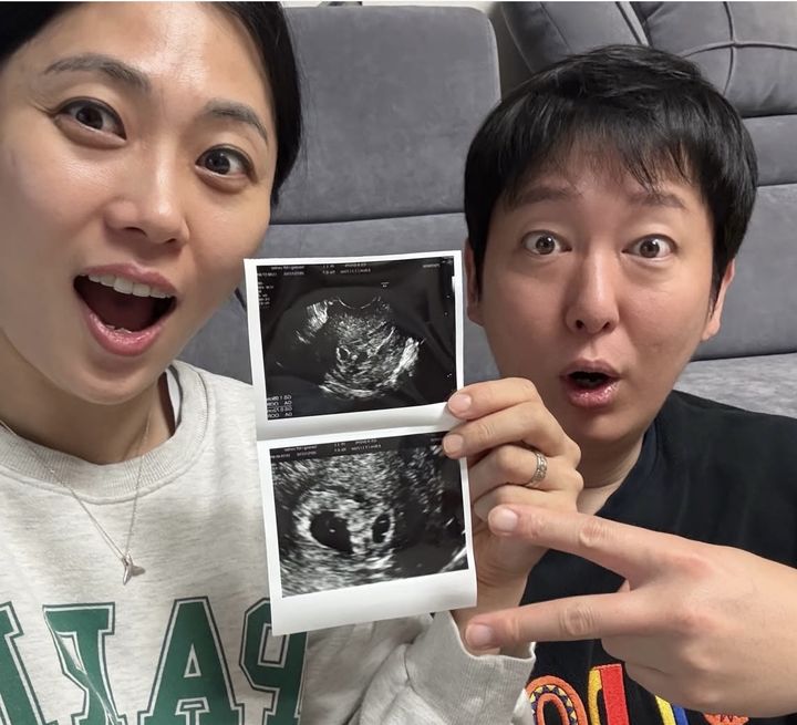 이동진♥김지연, 결혼 9년만 쌍둥이 임신 