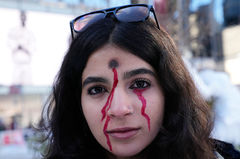 "이란 시위 부상자 X선서 실탄 피격 정황…'얼굴·가슴·생식기' 집중"