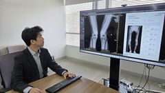 "엑스레이 한장으로"…AI가 10초만에 관절염 상태 판독[빠정예진]