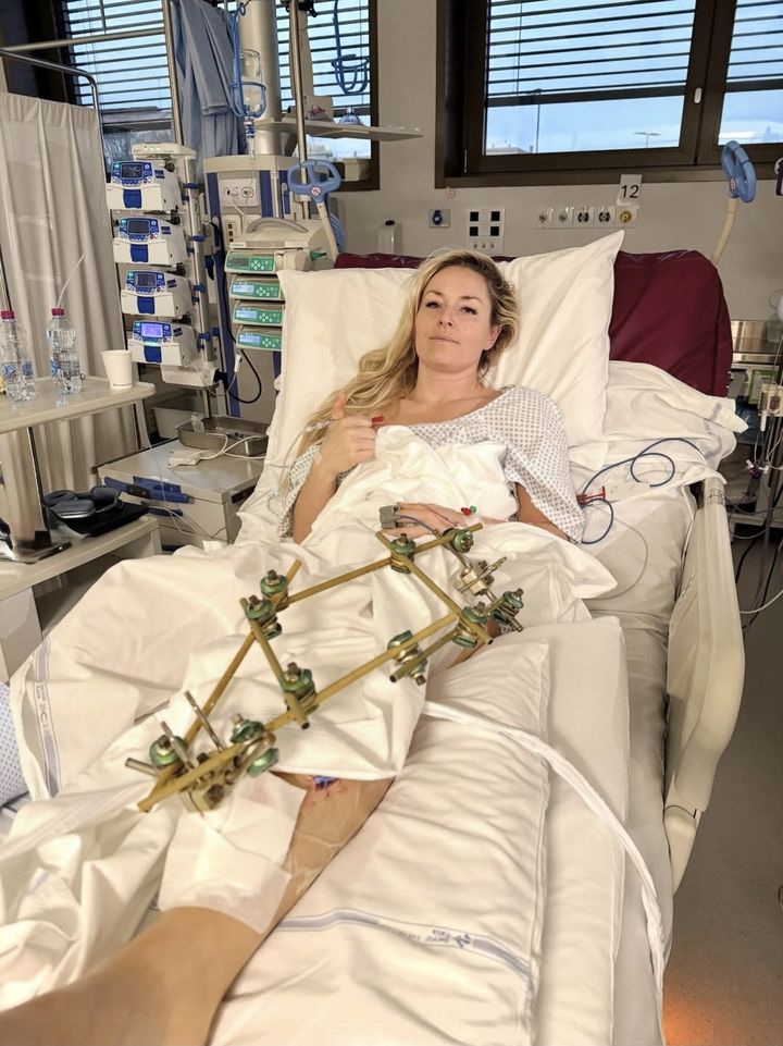 인천탐정사무소 서울탐정사무소 – ‘골절 부상’ 린지 본, 직접 전한 소식…”3번째 수술도 성공적”[2026 동계올림픽] 