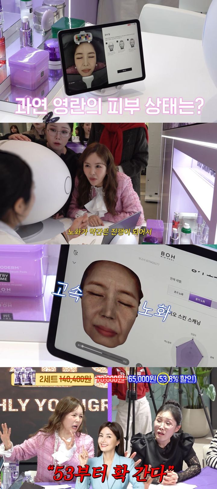 48세 장영란, 피부 노화 상태에 충격 