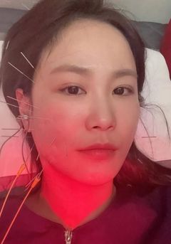 2세 준비하는 김지민 욕실 낙상사고 "볼 함몰됐다"