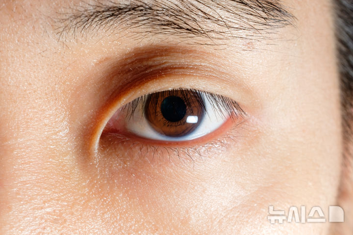 "눈 따갑고 이물감"…방치하면 시력 떨어지는 '이 질환'