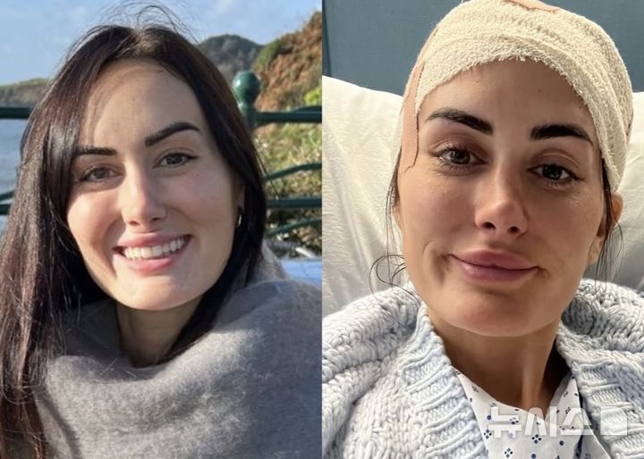 "가방에 머리 맞았는데 뇌종양 발견"… 英 20대 여성 사연