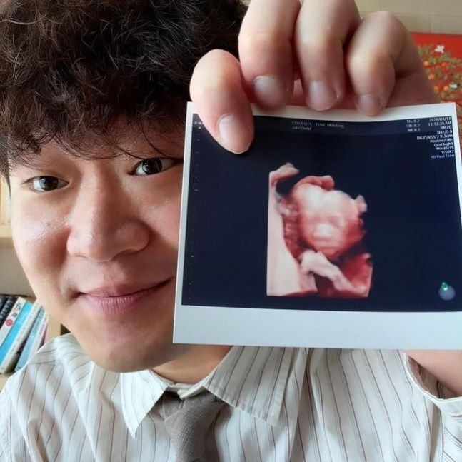 피식대학 정재형 아빠 된다 