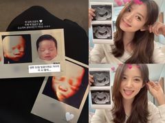 '혼전임신' 김지영, 딸 얼굴 공개