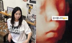 '최현석 딸' 최연수, 고통 호소…"갈비뼈 부러질 것 같아"