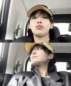 차주영, 코피 수술 3개월 만에 근황 공개…"아직 어색한 바깥 공기"