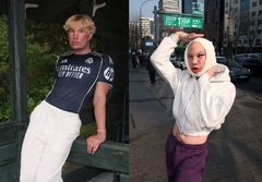 한국서 안면거상술 받은 핀란드 인플루언서…생생한 후기 '화제'