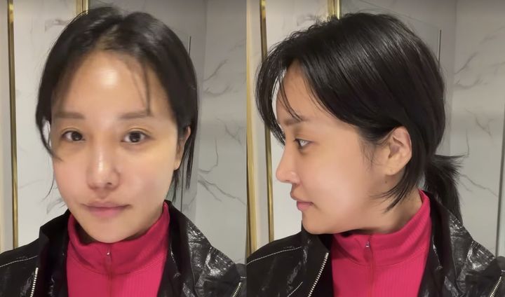 랄랄 '코 재수술' 후 날렵해진 콧대 자랑…
