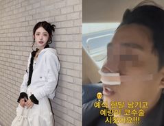 최준희, 결혼 앞두고 예비신랑 코성형…"사랑하면 닮아"