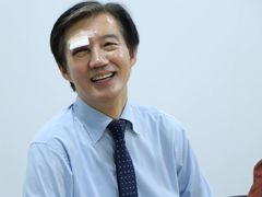 조국, 선거운동 중 부상…"멍든 눈으로도 뚜벅이는 계속"