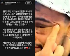 최두호에 패한 '코리안 킬러' 산토스…동양인 비하 논란에 결국 사과