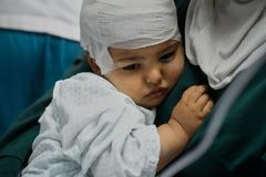 IDF 공습으로 다쳐 머리 수술 받은 레바논 아이