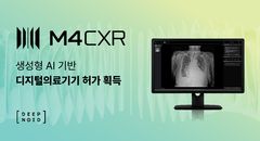 "AI와 만난 엑스레이"…촬영부터 판독까지 진화