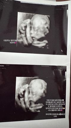 지드래곤, 둘째 조카 생긴다…친누나 권다미 임신