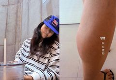진재영, 지네에 물려 종아리 퉁퉁…"살다살다 별일 다 있어"
