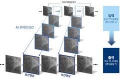 방사선노출 많은 '이 시술'…AI 적용하니 절반 '뚝'