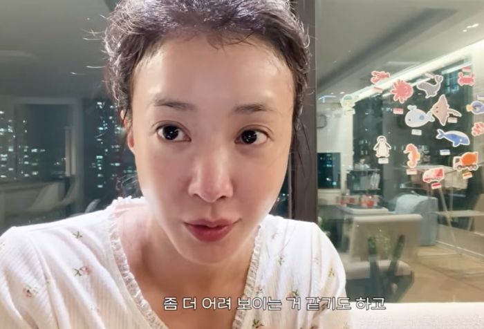 이시영, 아이라인 문신 제거…