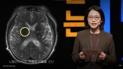 "30년 빨리 늙은 뇌"…서울대 의대 교수 "뇌졸중·치매 피하려면 이것부터"