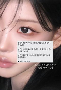故 최진실 딸 최준희, 또 눈 수술 "짝짝이 눈 탈출"