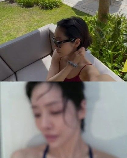 차주영, 오키나와서 건강해진 근황…지속적 비출혈(코피)로 수술까지