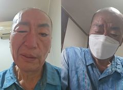 '8혼' 유퉁, 건강 악화로 활동 중단 "입 돌아가고 눈 안 감겨"