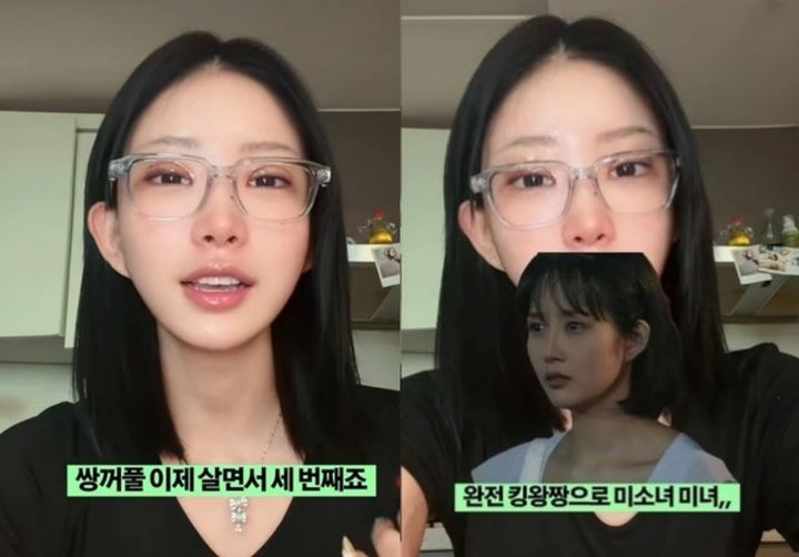 최준희, 성형 소신…"한 번 사는 인생, 최고 버전으로 살고파"