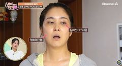장가현, 운동 강박으로 달라진 얼굴…진한 다크서클·꺼진 볼